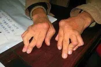 火疗小周天视频,揭秘传统养生秘法